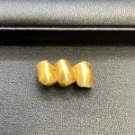 金歯