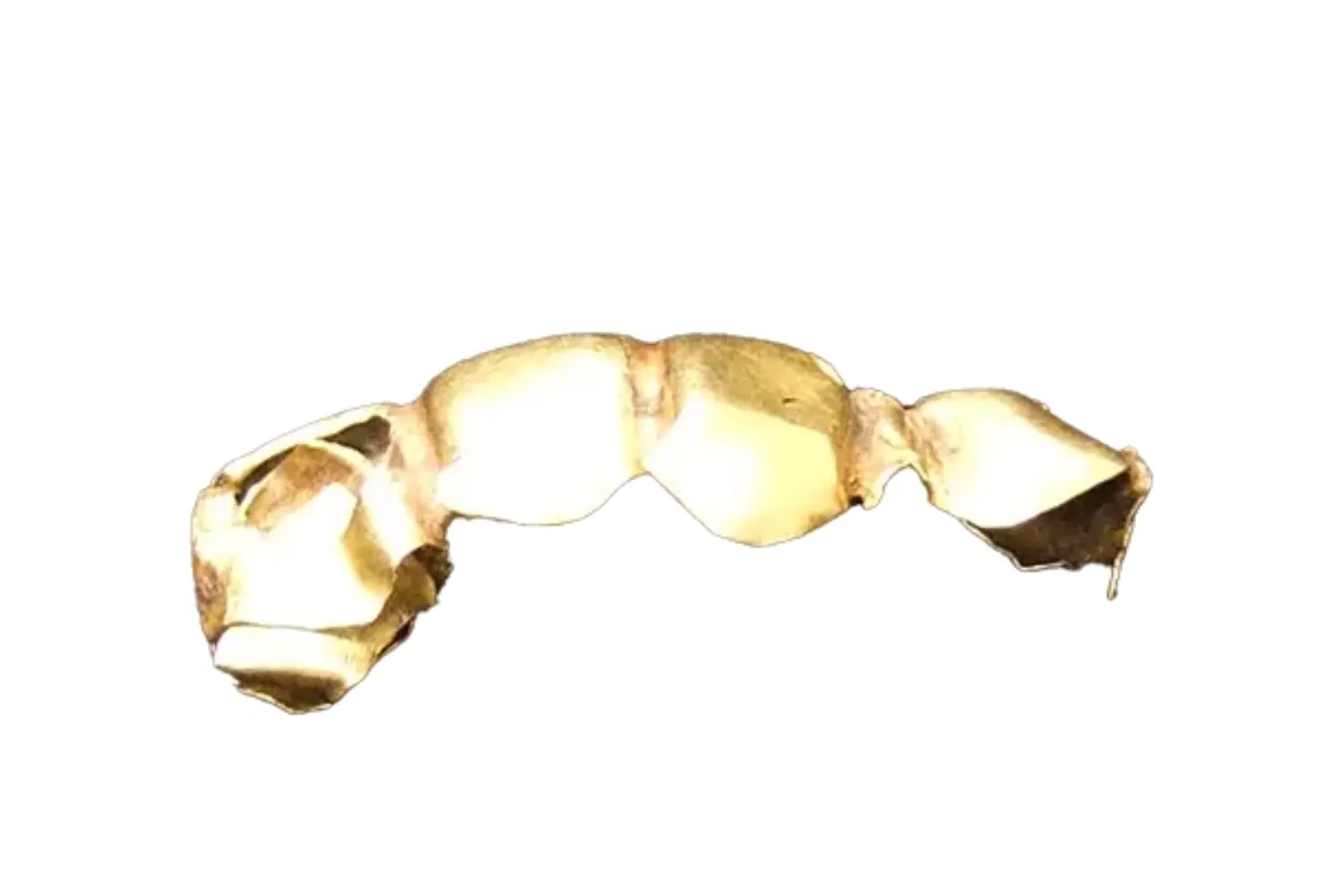 金歯のメリットとは？捨てずに得する方法と高価買取のヒントまで徹底解説！