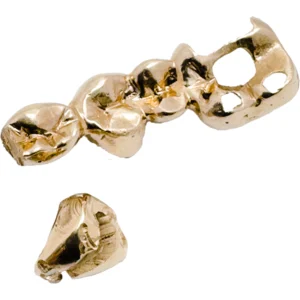 タンスの奥にあった金歯