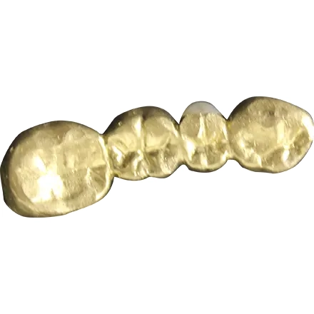 金歯買取